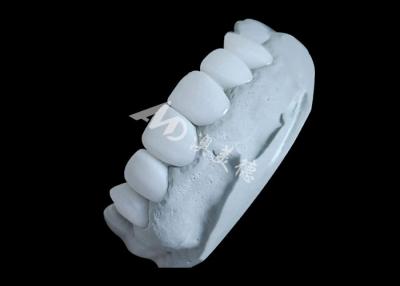 China Translucidez Laboratorio Dental Coroa de zirconia Fuerza inmejorable Suavidad natural en venta