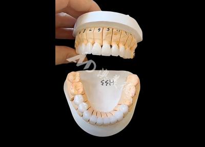 China Corona dental de zirconia de translucidez mejorada para restauraciones fijas de unidad única o múltiple en venta