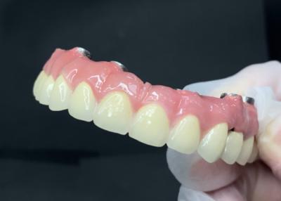 China Implantes Dentários Duráveis com Abutment de Titânio de Limpeza Fácil e Coroa de Circônio à venda