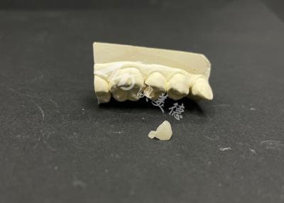 China Resistente a las manchas Emax Cerámica para restauraciones dentales para reparar los dientes dañados con precisión en venta