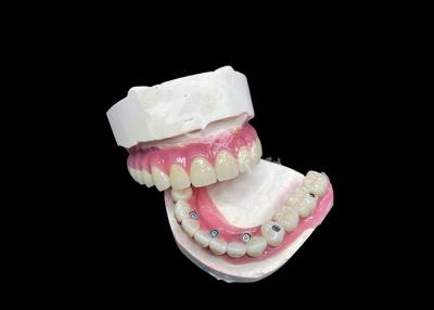 Cina Impianto dentale circonico, ponte corona, tutti a 6 per la sostituzione dei denti mancanti. in vendita