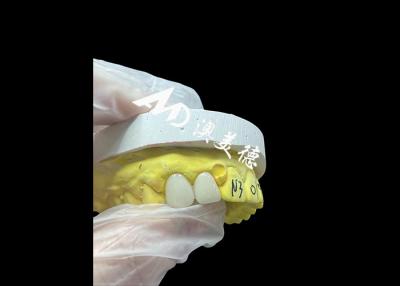 China Natural Zirconia Dental Crowns With High Strength And Biocompatibility for sale