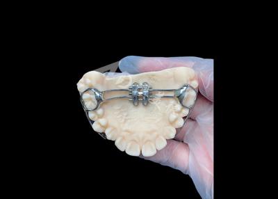 Chine MSE expansateur palatal Appareils orthodontiques innovants pour un alignement efficace des dents à vendre