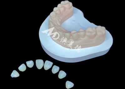 China IPS e.max Veneer Premium Solução Estética para Transformações de Sorriso Impressionantes à venda