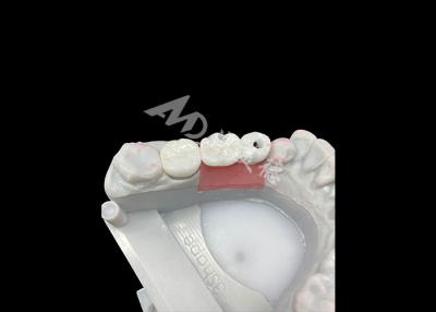 China Coroas de implante dentário de zircônio com abutment de titânio para maior conforto e estética à venda