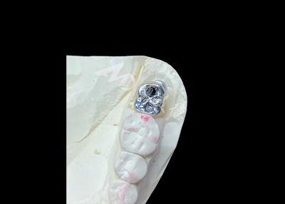 China Coroa de Implantes Dentários com Abutment de Titânio e Coroa de PFM de porcelana fundida a metal à venda