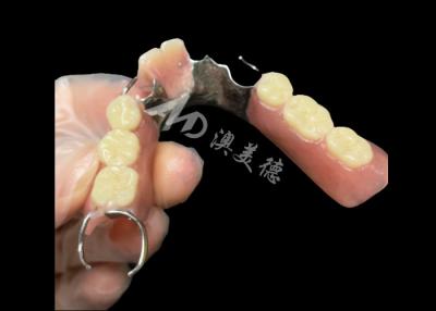 Chine Dentures partielles en titane coulées avec fermetures reposant avec les dents à vendre