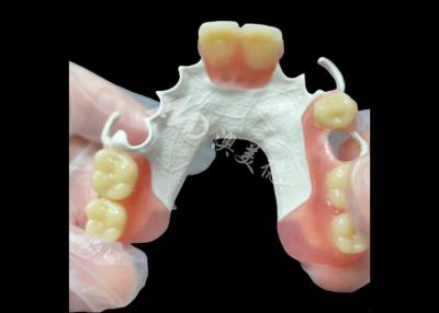 Chine Prothèse dentaire partielle amovible esthétique sur mesure Cadre HPP pour le remplacement partiel des dents naturelles à vendre