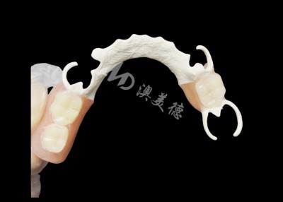 Κίνα Custom Cast Partial Denture with HPP framework for Enhanced Chewing and Speech προς πώληση