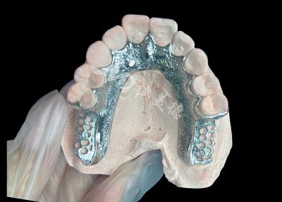 China Cuadro dentario de prótesis dentaria sin dientes diseñado para la estabilidad y la función en venta