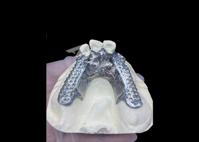 China Fácil de ajustar Custom Cast Partial Denture Marco estable y de aspecto natural para resultados rápidos en venta