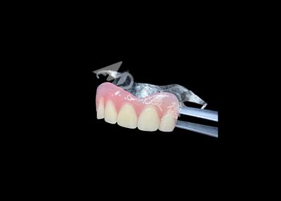 China Dentaduras parciales fundidas de larga duración Mantenimiento fácil para una mejor masticación y una sonrisa perfecta en venta