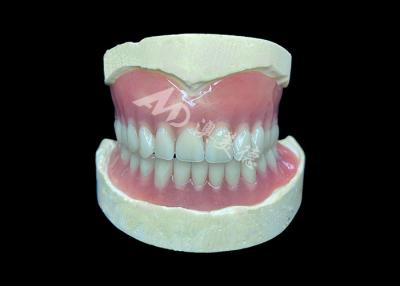 China Dentaduras parciales de fundición a medida, fáciles de limpiar, ideales para restaurar la capacidad de masticar y las sonrisas en venta