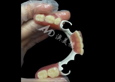 Κίνα Custom Made Durable Cast Partial Dentures With Hpp Framework For Restoring Your Smile προς πώληση