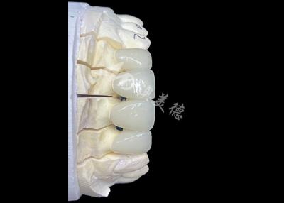 China Ponte de coroa cerâmica de zircônio de aparência natural proporciona precisão e estética combinadas à venda