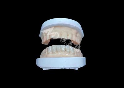 China IPS Emax Veneers Natürliche Wiederherstellung für ein ästhetisches Lächeln zu verkaufen