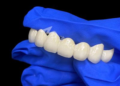 China High Translucency Lava Zirconia Dental Bridge Seamless Blend With Natural Teeth for sale