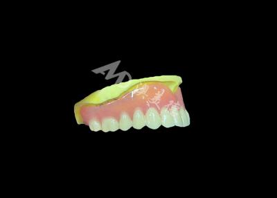 Κίνα Cast Partial Dentures Crafted for Durability Comfort and Aesthetic and Lasts Longer προς πώληση