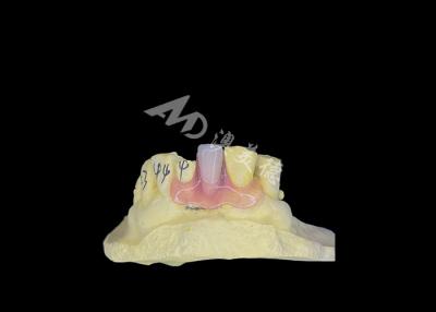 China Nesbit Flexible Partial Denture voor comfort en duurzaamheid bij tandvervanging Te koop