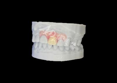 China Nesbit Flexible Partial Denture ontworpen voor een natuurlijke pasvorm en langdurig comfort Te koop