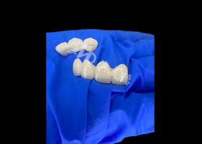 China Wieland Zenostar Ceramic Crown Bridge High Precision for Durable and Natural Looking Restorations for sale