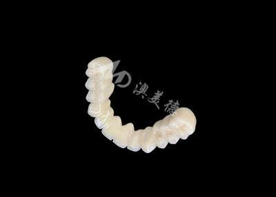 China Long-lasting Bonding PFM Dental Crown Bridge With Excellent Biocompatibility Secure Bonding for sale