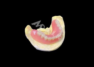 Cina Protesi dentali in acrilico completo Denti rimovibili personalizzate Facile da pulire e durevole in vendita