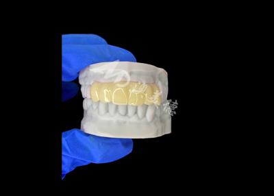 China Lightweight Biocompatible 3D Printed Hollow Temporary Bridge for Pre Implant Restorations for sale