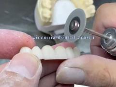 Resistance Zirconia Dental Crown for Aesthetic Smile Precise Fit Excellent Biocompatibility