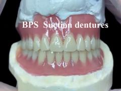 BPS suction dentures as an effective removable denture solution for enhanced comfort and stability