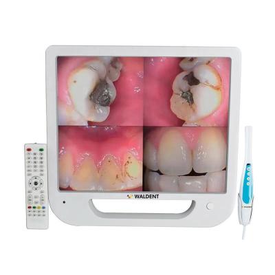 China 17inch 5 Megepixel intra metal all-in-one dental oral camera for sale