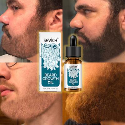 Cina Moisturize Best Private Label Beard Growth Oil 20ml Beard Growth Oil Beard Serum For Men in vendita