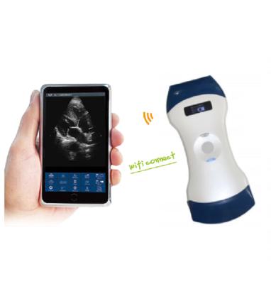 China Cheapest Mini Wireless Handheld Portable Ultrasound Wireless Abdomen Ultrasound Radio for sale