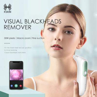 China Black Head Removal Rechargeable Blackhead And Electric Facial Suction Button Machine Black Waterproof Vacuum Remover Custom for sale