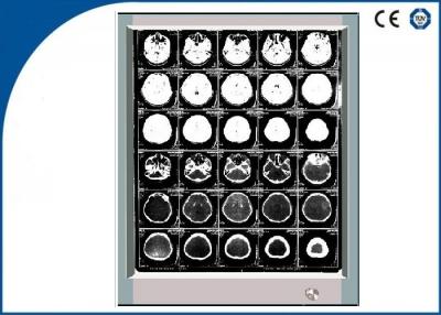 China Film-Zuschauer-Acrylschirm der Helligkeits-örtlich festgelegter LED X Ray mit einzelner LED zu verkaufen