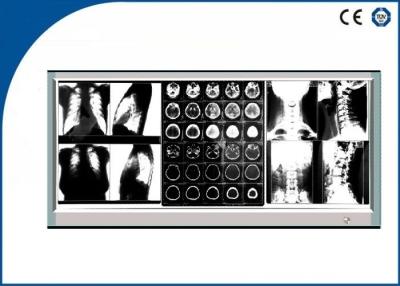 China 60W Triple LED X Ray Film Viewer Brightness Fixed for Medical Treatment for sale