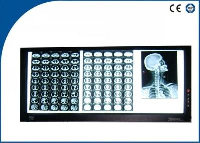 China Ultra Thin Triple LED Radiography Film Viewer , Rotary Knob Switch Independent Control for sale