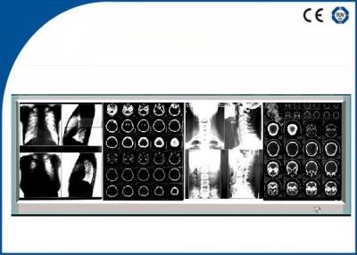 China Brightness Fixed LED Medical Film Negatoscope , Four LED Screen Film Viewer for sale