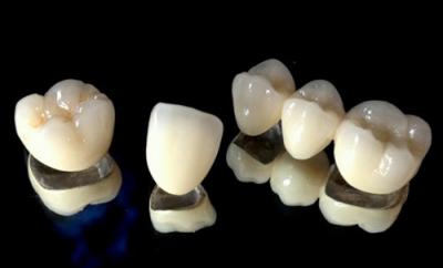 China Emergency Temporary Dental Crown Implant Replacement Professional PMMA for sale