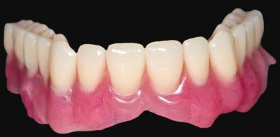 China 3D Printed Resin Temporary Crown Smooth Surface Dentures Dental Labs for sale