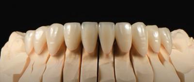 China Implant Abutment Zirconia Dental Crown Natural All On Four Dentures for sale