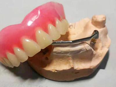 China Metal-Free FDA All Zirconia Crown OEM Implant-Supported Dentures for sale