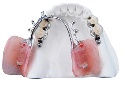 China Zirconia Dental Crown | Zirconia Dental Lab in for sale