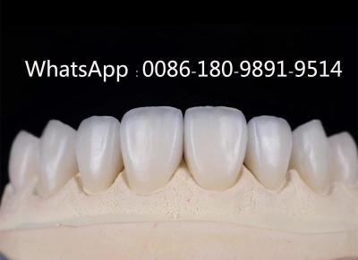 China Dental Zirconia China lab- Factory, Suppliers-manufacturer for sale