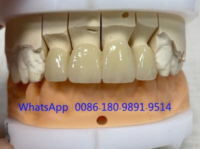 China Zirconia dental lab China manufacturer Zirconia Bridge China Dental Lab for sale