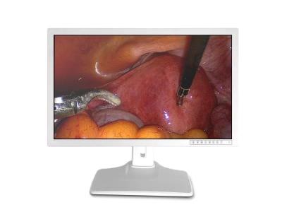 China Het medische Scherm 32inch 3840 X 2160 van de Endoscoopmonitor Te koop