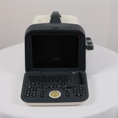 China UN6602 Metal New Product Portable Ultrasound System for sale