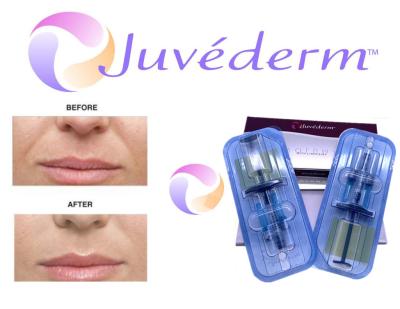 China 2x1ml Cross Linked Juvederm Dermal Filler For Face Wrinkle Filling for sale