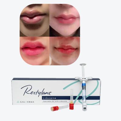 China Precio al por mayor de relleno cutáneo inyectable para labios en venta