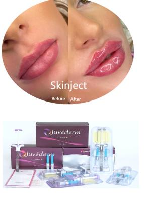 Chine Juvederm Acide hyaluronique Remplisseur cutané facial injectable à vendre